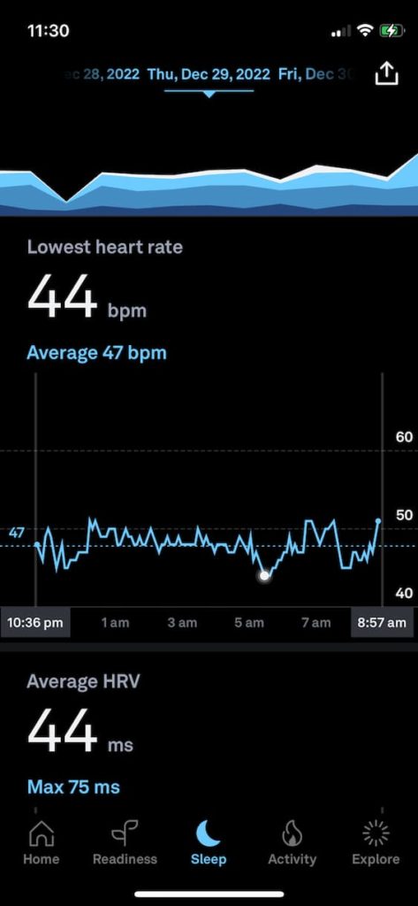 HRV and Heart Rate during sleep after a PEMF therapy treatment